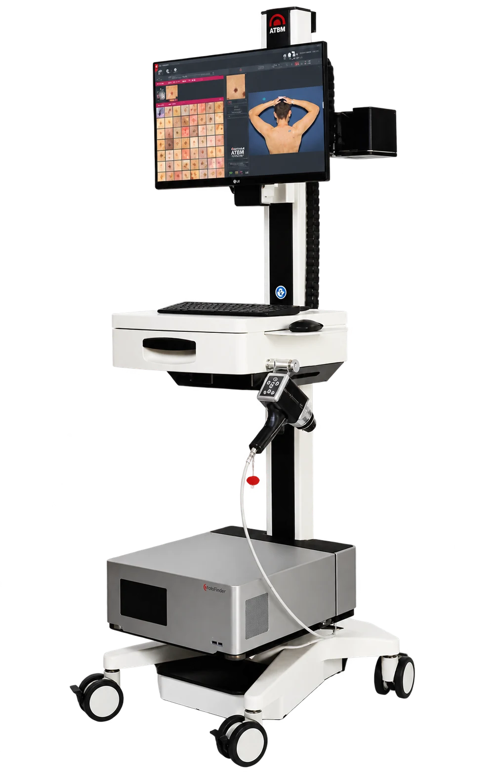 FotoFinder ATBM Master